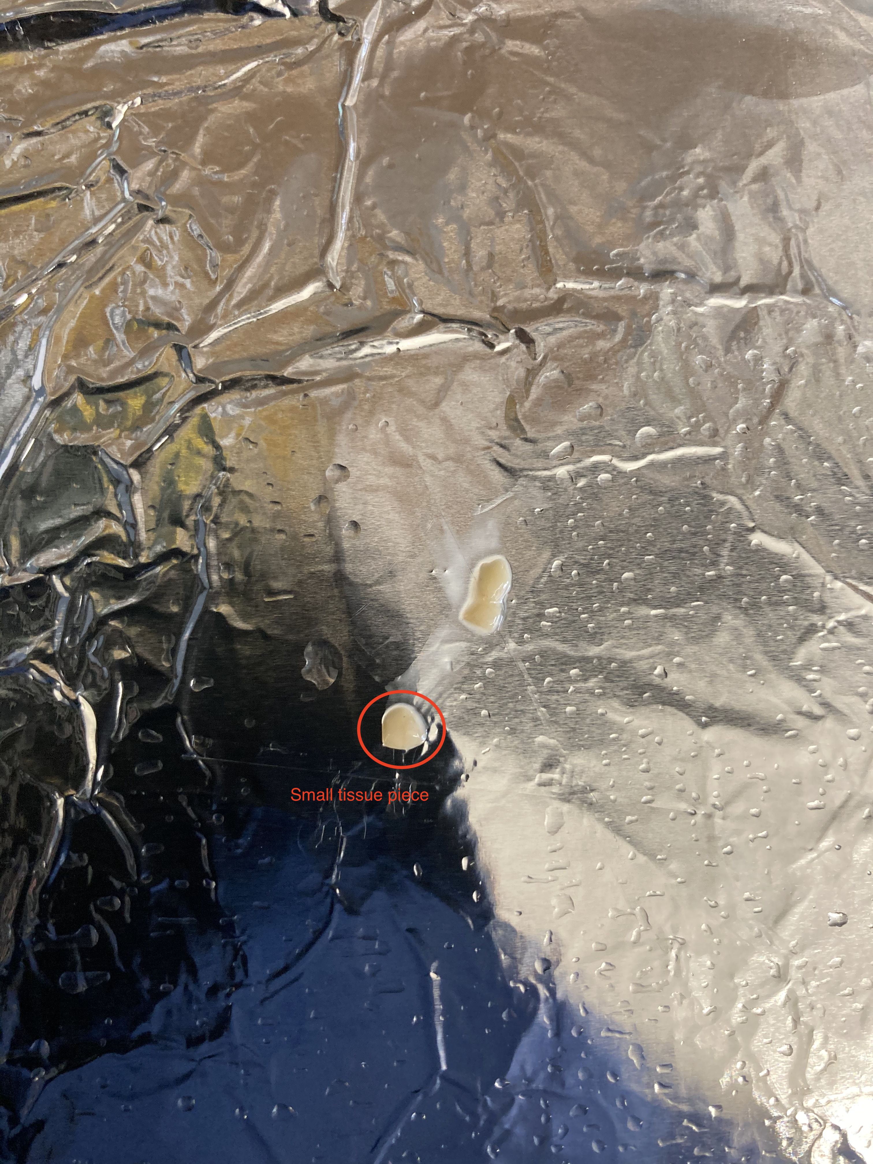 KIC2_M1